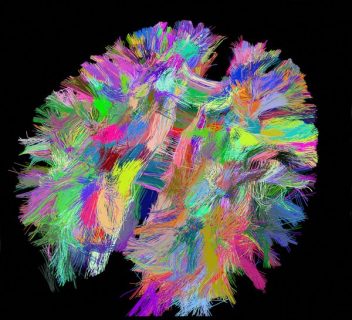 Principaux faisceaux de connexions cérébrales reconstitués à partir d’images d’IRM